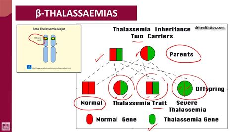 Beta thalassaemia trait (carrier) – GPnotebook.